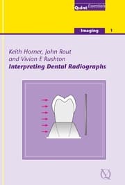 Cover von Interpreting Dental Radiographs