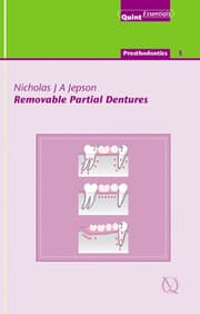 Cover von Removable Partial Dentures