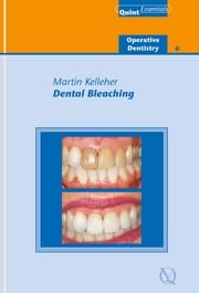 Cover von Dental Bleaching