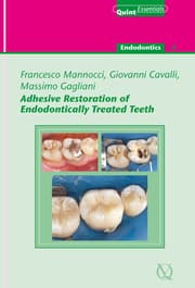 Cover von Adhesive Restoration of Endodontically Treated Teeth