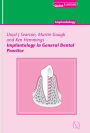 Cover von Implantology in General Dental Practice