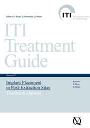 Cover von Implant Placement in Post-Extraction Sites