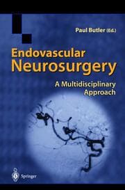 Cover von Endovascular Neurosurgery