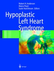Cover von Hypoplastic Left Heart Syndrome