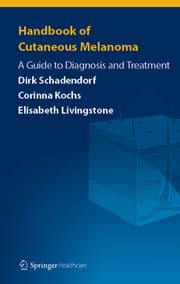 Cover von Handbook of Cutaneous Melanoma