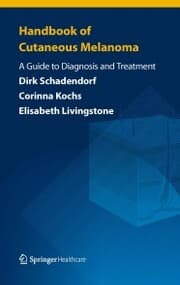 Cover von Handbook of Cutaneous Melanoma
