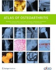 Cover von Atlas of Osteoarthritis