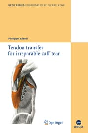 Cover von Tendon transfer for irreparable cuff tear