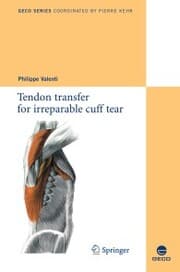 Cover von Tendon transfer for irreparable cuff tear