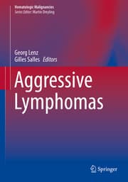 Cover von Aggressive Lymphomas