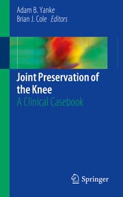 Cover von Joint Preservation of the Knee