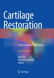 Cover von Cartilage Restoration