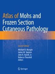 Cover von Atlas of Mohs and Frozen Section Cutaneous Pathology