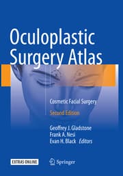 Cover von Oculoplastic Surgery Atlas