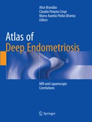 Cover von Atlas of Deep Endometriosis