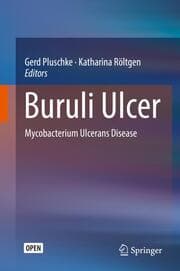 Cover von Buruli Ulcer