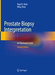 Cover von Prostate Biopsy Interpretation