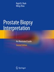 Cover von Prostate Biopsy Interpretation