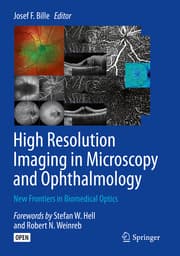 Cover von High Resolution Imaging in Microscopy and Ophthalmology