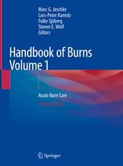 Cover von Handbook of Burns Volume 1