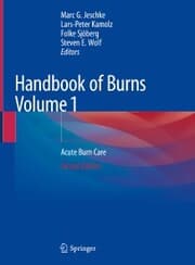 Cover von Handbook of Burns Volume 1