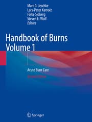 Cover von Handbook of Burns Volume 1