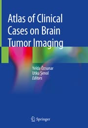 Cover von Atlas of Clinical Cases on Brain Tumor Imaging