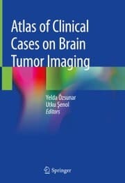 Cover von Atlas of Clinical Cases on Brain Tumor Imaging