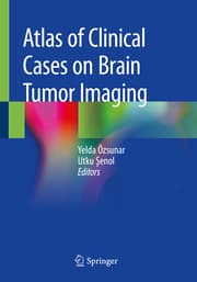 Cover von Atlas of Clinical Cases on Brain Tumor Imaging