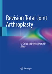 Cover von Revision Total Joint Arthroplasty