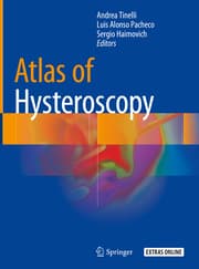 Cover von Atlas of Hysteroscopy