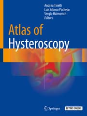 Cover von Atlas of Hysteroscopy