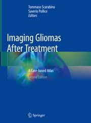 Cover von Imaging Gliomas After Treatment