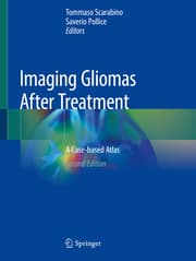 Cover von Imaging Gliomas After Treatment