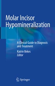 Cover von Molar Incisor Hypomineralization