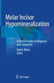 Cover von Molar Incisor Hypomineralization
