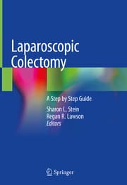Cover von Laparoscopic Colectomy