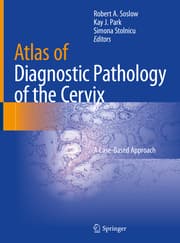 Cover von Atlas of Diagnostic Pathology of the Cervix