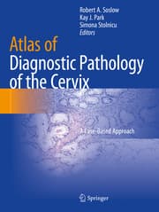 Cover von Atlas of Diagnostic Pathology of the Cervix