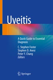 Cover von Uveitis