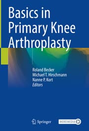Cover von Basics in Primary Knee Arthroplasty