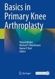 Cover von Basics in Primary Knee Arthroplasty