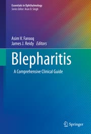 Cover von Blepharitis