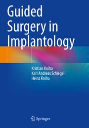 Cover von Guided Surgery in Implantology