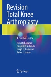 Cover von Revision Total Knee Arthroplasty