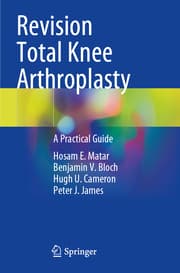 Cover von Revision Total Knee Arthroplasty