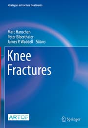 Cover von Knee Fractures