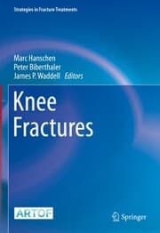 Cover von Knee Fractures