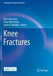 Cover von Knee Fractures