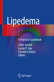 Cover von Lipedema